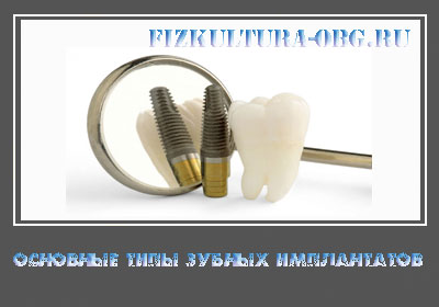 Основные-типы-зубных-имплантатов